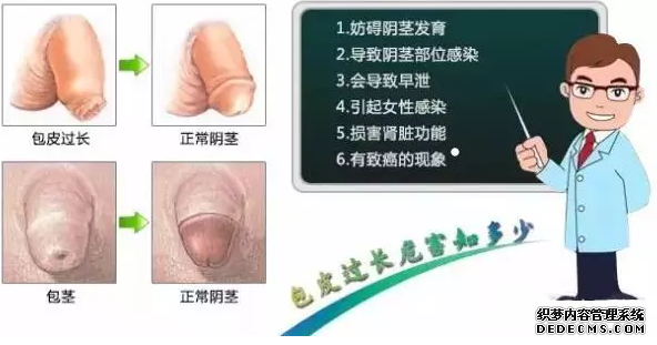 马鞍山有人能说说自己割包皮有多“痛”吗？