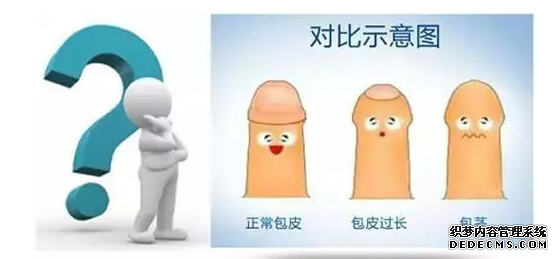 马鞍山割完包皮手术正确认知及注意事项