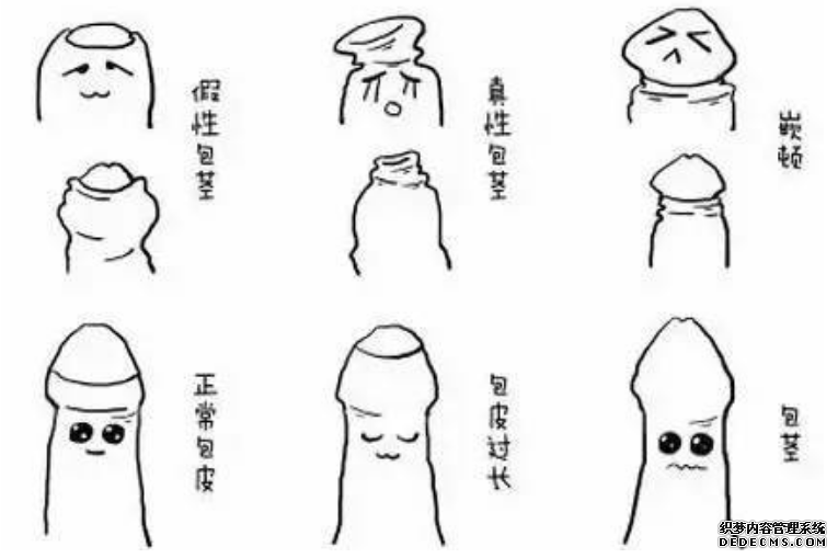 马鞍山真假包茎PK大战一触即发,你辨得清?