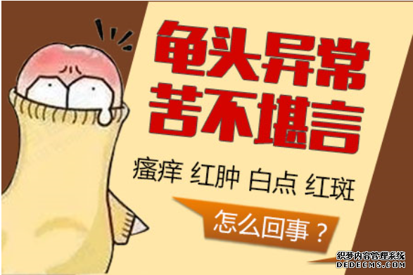 马鞍山男性龟头炎常见的症状?再忙也要看!