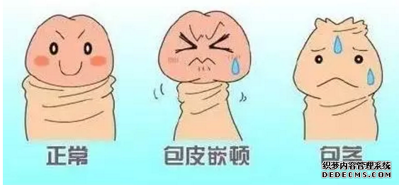 马鞍山包皮过长容易造成感染性疾病