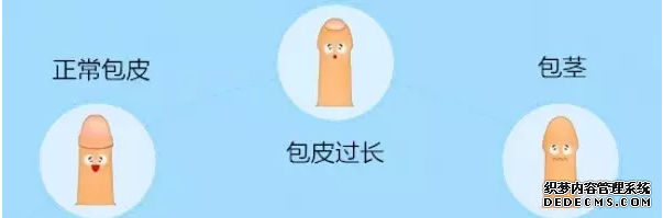 马鞍山当涂县儿童包皮过长怎么治疗