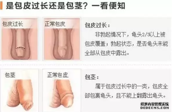 当涂县包皮手术什么时候适合？医生告诉你答案