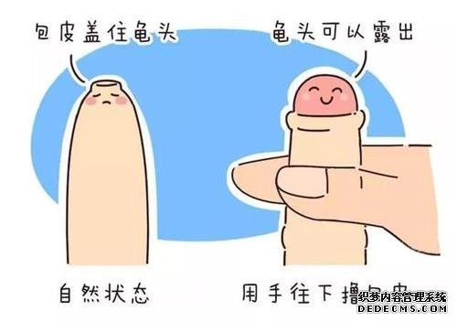马鞍山和县请问什么叫做男性假性包皮过长?